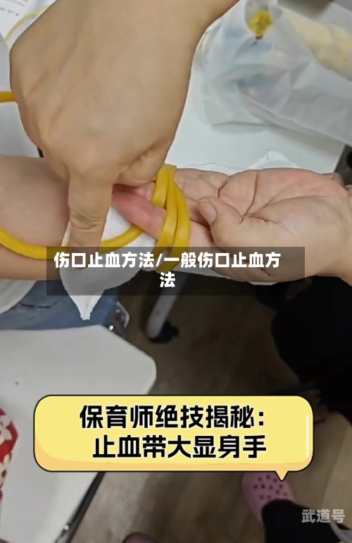 伤口止血方法/一般伤口止血方法